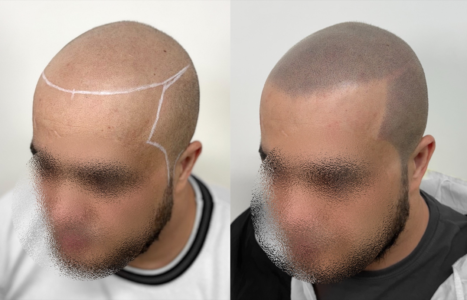 Shaved look SMP portfolio 30